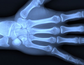 Рентген суставов руки
